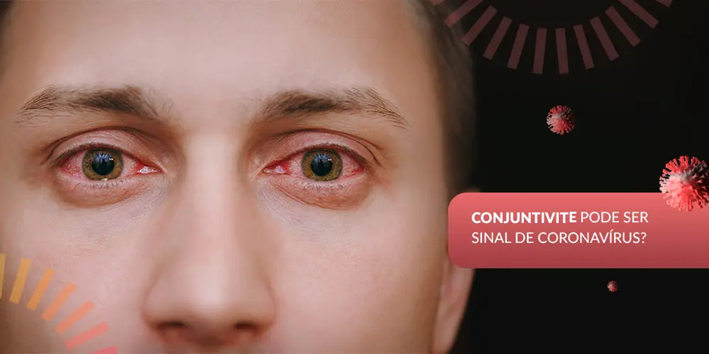Close-up de um homem branco com os olhos vermelhos e irritados, ao lado de ilustrações do coronavírus e da pergunta "CONJUNTIVITE PODE SER SINAL DE CORONAVÍRUS?".
