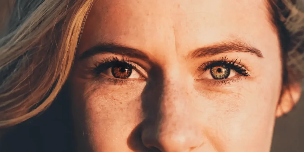 Close-up do rosto de uma mulher branca com heterocromia, apresentando um olho castanho e outro verde, em imagem relacionada a doenças oftalmológicas.